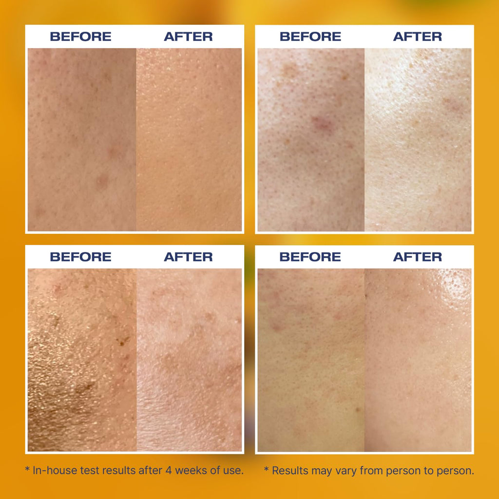ZOLOPIX MINTAVI20 20% Vitamin C Serum with Alpha Arbutin & Tranexamic Acid | Brighten Dark Spots (26 ml)