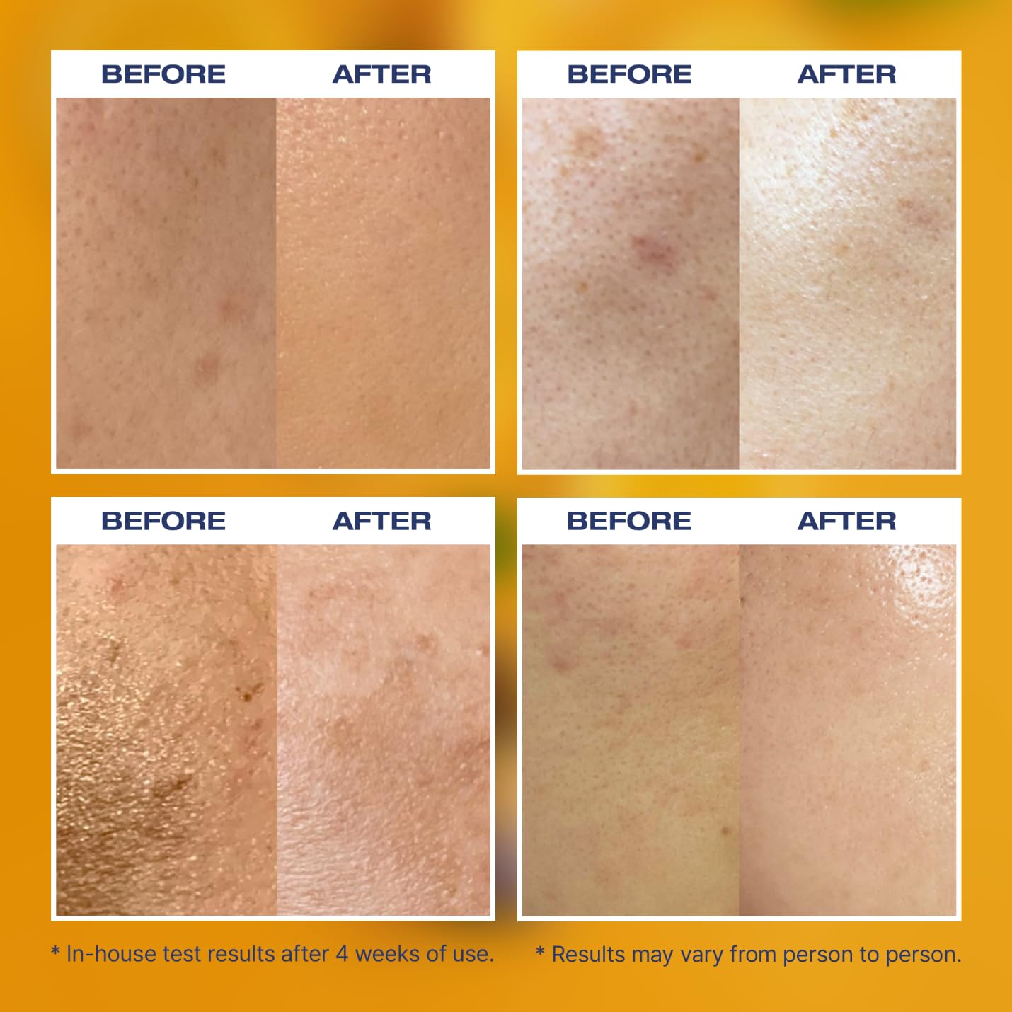 ZOLOPIX MINTAVI20 20% Vitamin C Serum with Alpha Arbutin & Tranexamic Acid | Brighten Dark Spots (26 ml)